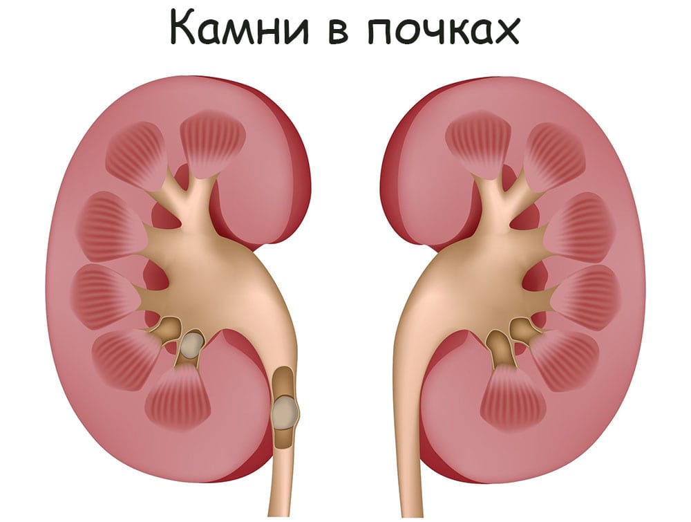 Кракен супернет рекламы